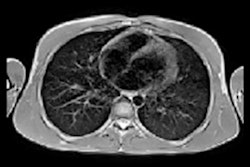 2022 09 20 21 17 0648 2022 09 21 Mri Kids Long Covid C 400