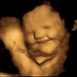 2022 09 21 21 43 4207 2022 09 21 Durham U Ultrasound Fetus Laugh 20220921214124