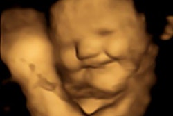 2022 09 21 21 43 4207 2022 09 21 Durham U Ultrasound Fetus Laugh 20220921214124
