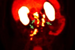 2022 09 27 21 29 9234 2022 09 26 Blue Earth 20220927211614