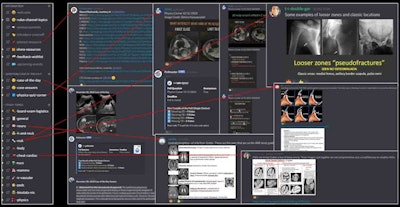RadDiscord educational content created by radiology residents. Image courtesy of Dr. Grace Zhu.