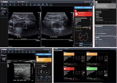 Koios-DS is an ultrasound AI platform for assessing breast and thyroid lesions. Image courtesy of Koios.