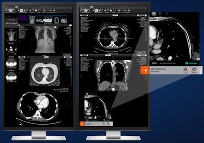AI Operating System. Image courtesy of Aidoc.