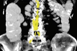 2022 09 28 20 14 8384 2022 09 28 Body Comp Ct Figure3 20220928204047