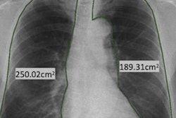 2022 09 30 23 43 5710 2022 10 03 Dxr Copd 20220930230943
