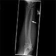 2022 10 10 20 13 2220 2022 10 10 Nightstick Fracture 400