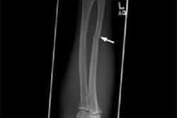 2022 10 10 20 13 2220 2022 10 10 Nightstick Fracture 400