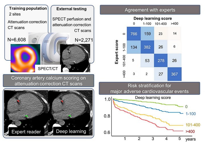 SPECT/CT AI model predicts major adverse cardiac events | AuntMinnie