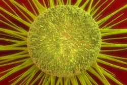 2022 10 11 19 12 6538 Cancer Cell Yellow 400