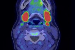 2022 10 12 16 31 5345 2022 10 12 C 11 Choline Parathyroid 400 jpg
