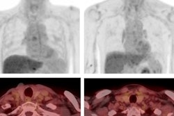 2022 10 12 23 37 3218 2022 10 13 Hypothyroidism 400