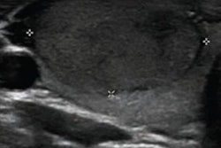 2022 10 19 23 15 2422 2022 10 19 Ajr Ultrasound Thyroid 20221019232732