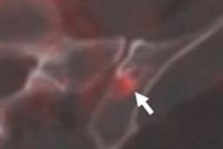 2022 10 25 23 44 2260 2022 10 26 Pylarify Bone 20221025235714