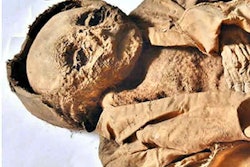 2022 10 26 20 41 9843 2022 10 26 Frontiers Baby Mummy Fig 1 400