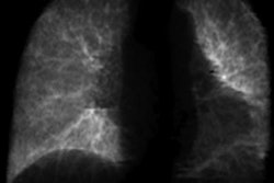 2022 10 26 23 52 2938 2022 10 27 Ai Pulmonary Fibrosis 20221026235626
