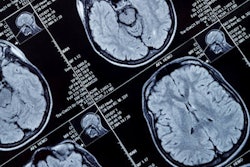 2019 02 20 20 38 9544 Mri Brain Head 400