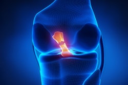 2019 08 23 21 27 6833 Knee Joint Torn Acl 400