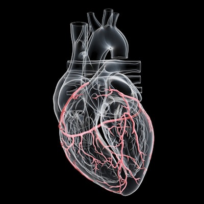 2020 08 26 18 55 9693 Artery Heart 3 D 400