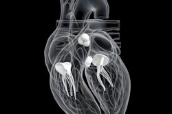 2022 11 03 18 48 6527 Heart Valves 3 D 400