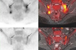 2022 11 10 19 38 7897 2022 11 10 Pet Mri Atherosclerosis 400
