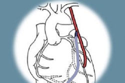 2022 11 10 22 21 3357 2022 11 11 Spect Cabg 400