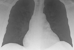 2022 11 14 18 29 0531 2022 11 14 Covid 19 X Ray 20221114183121