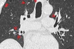 2022 11 16 03 09 2021 2022 11 15 Radiology Ct Marijuana Effects 20221116030610