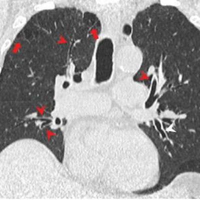 2022 11 16 03 09 2021 2022 11 15 Radiology Ct Marijuana Effects 20221116030610