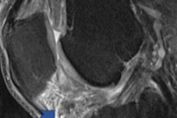 2022 11 21 03 29 7185 2022 11 21 Rsna Pr Fat Pad 20221121035526