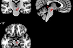 2022 11 21 04 02 4919 2022 11 21 Brain Abnormalities 20221121042148