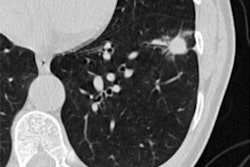 2022 11 21 23 47 6344 2022 11 22 Rsna Lung Screen 20221121230927