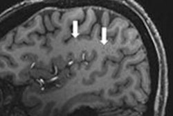 2022 11 23 15 48 9433 2022 11 23 Rsna Brain Mri 400