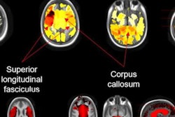 2022 11 23 18 06 7808 2022 11 28 Rsna Brain Mri Children 20221123181416