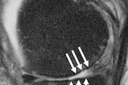 2022 11 23 18 35 0577 2022 11 29 Rsna Knee Arthritis 20221123183627