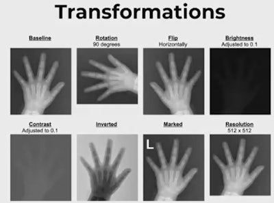 The Maryland group tested the DL model on image transformations by comparing mean absolute differences (MAD) of the model's predictions on baseline (untransformed) vs. transformed images with t-tests, as well as proportions of clinically significant errors.