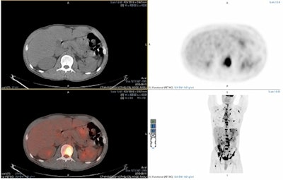 Image demonstrating the viewing panel from Mirada XD. Image courtesy of Dr. Andrew Scarsbrook.