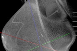 2015 02 11 10 21 27 356 Koning Breast Ct Images 200