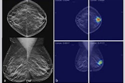 2022 12 01 19 21 1982 2022 12 1 Rsna Ai Dbt 400