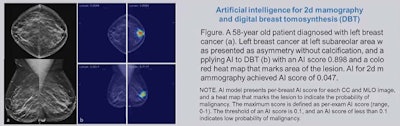 Research led by a team from Lunit showed that AI models using digital breast tomosynthesis perform better than models using digital mammography. Image courtesy of Su-A Yang.