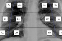 2022 12 14 23 41 3022 2022 12 13 Brixia Score 20221215000050