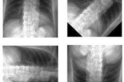 2022 12 20 18 25 9362 2022 12 20 Aorta X Ray 400