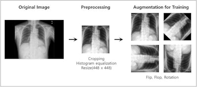 Image preprocessing. Image courtesy of Scientific Reports through CC BY 4.0 International License.