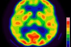 2022 12 21 02 53 0186 2022 12 20 Keto Brain 20221221025117