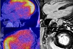 2022 12 22 00 40 4965 2022 12 16 Fapi Pet Cardiac Fibrosis 20221222001554