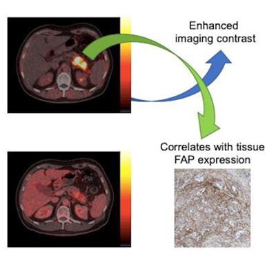 PET Imaging of Fibroblast Activation Protein in Various Types of Cancer  Using 68Ga-FAP-2286: Comparison with 18F-FDG and 68Ga-FAPI-46 in a  Single-Center, Prospective Study