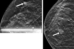 2023 01 11 00 50 4267 2023 01 10 Radiology Dcis 400 20230111002152