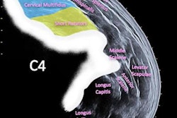2023 01 11 21 02 6896 2023 01 11 Panoramic Ultrasound 20230111213259