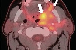 2023 01 12 23 47 1458 2023 01 13 Surveillance Imaging 20230112232525