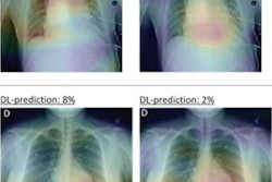 2023 01 18 01 13 4841 2023 01 18 Ai Acp Syndrome 20230118014002