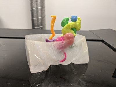 A 3D-printed model shows the genitourinary system of a 13-month-old girl. This model consists of hemibladders (pink), duplicated vaginas (purple), uterine horns (light purple), ureters (orange and green), ovaries (blue), urethra (pink), colon (yellow), and a body extent (clear). The sides of the body are flat due to the imaging field of view. Images courtesy of Urology.
